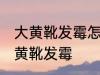 大黄靴发霉怎么洗掉霉斑 如何解决大黄靴发霉